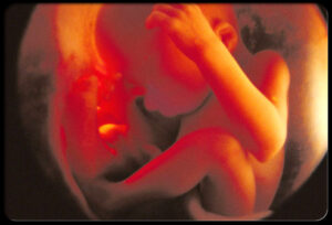 Female Infanticide Continues to Haunt India