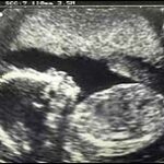 Indian Infanticide Causing A Population Imbalance