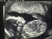 Indian Infanticide Causing A Population Imbalance