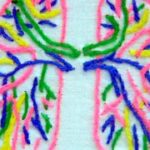 Update on “Totally Drug Resistant” Tuberculosis