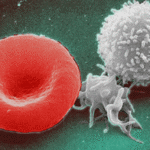 The Week in Global Health: Decrease in US Funding for NTDs; Serodiscordant Relationships