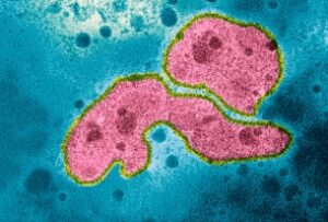 Bird Flu Virus Research Moratorium